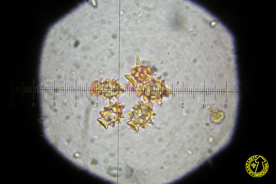 Stephanospora caroticolor