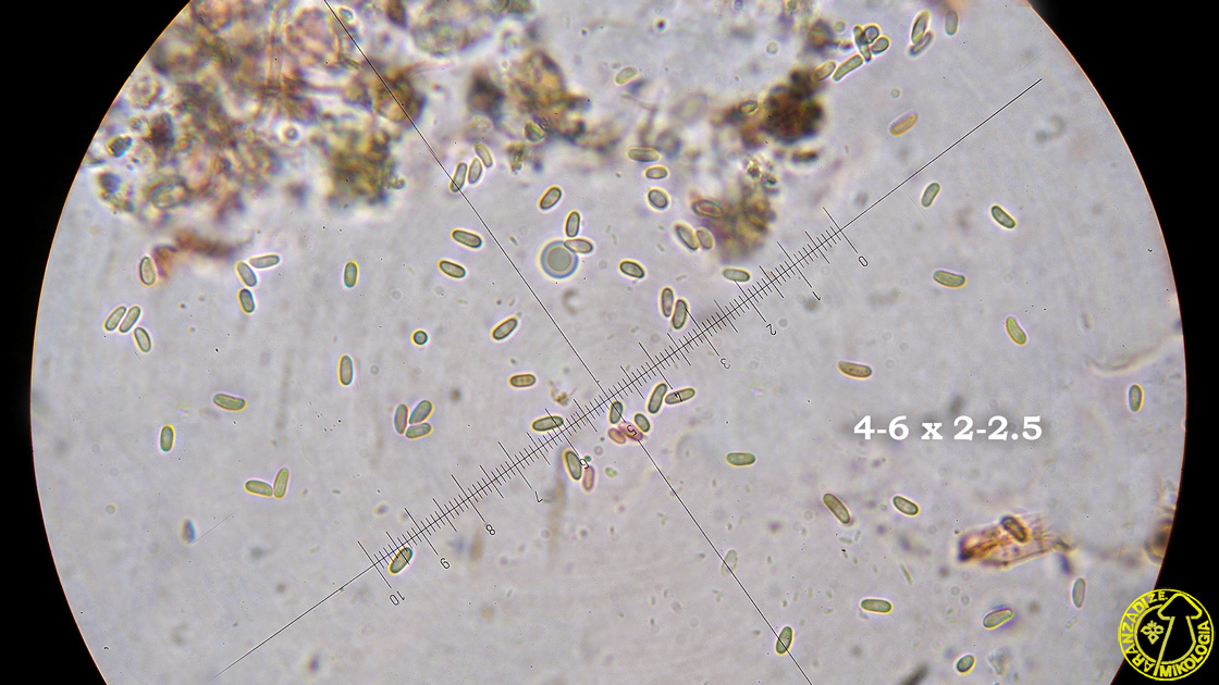 Ascocorticium anomalum
