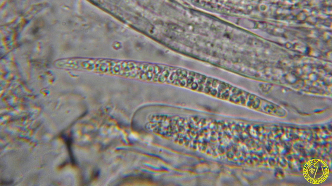 Thaxteriella corynespora
