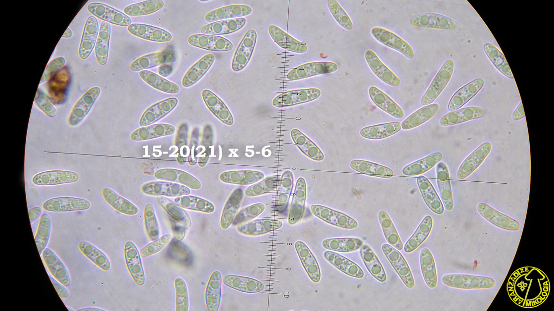 Ascocoryne sarcoides