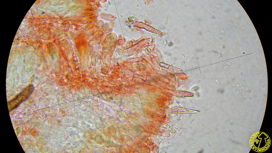 Peniophora pseudoversicolor