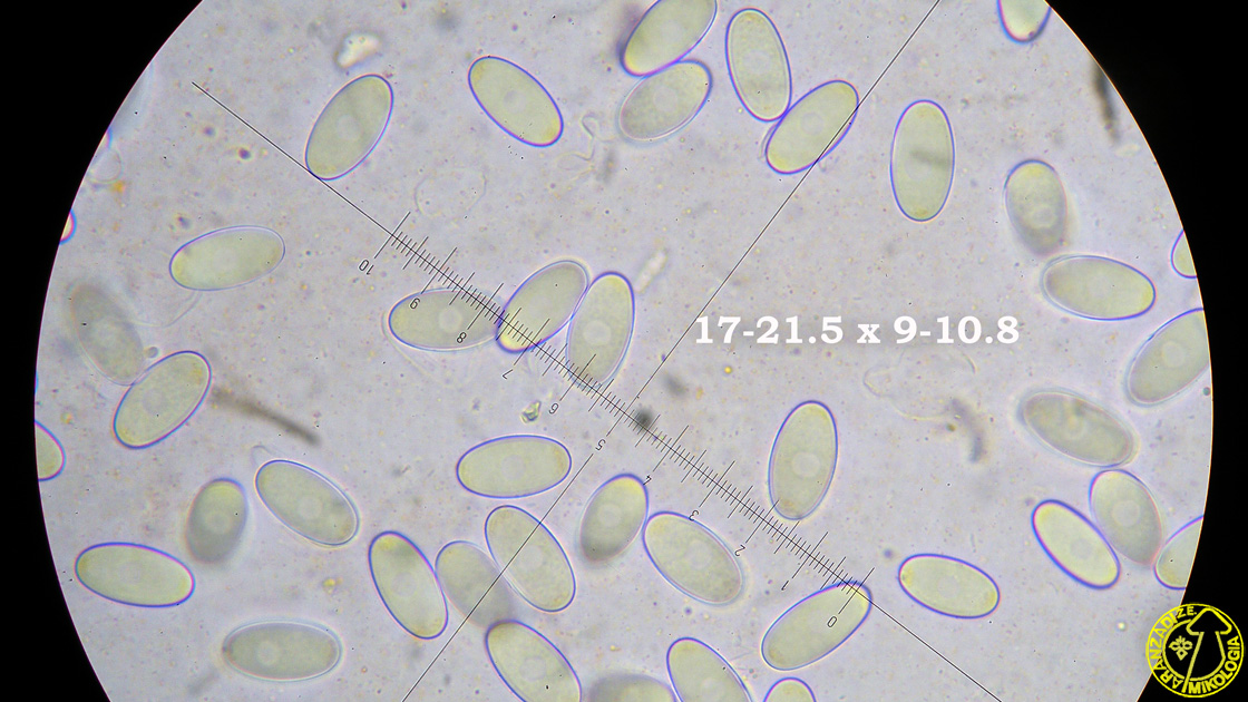 Cheilymenia stercorea