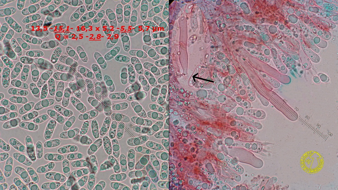 Vuilleminia macrospora