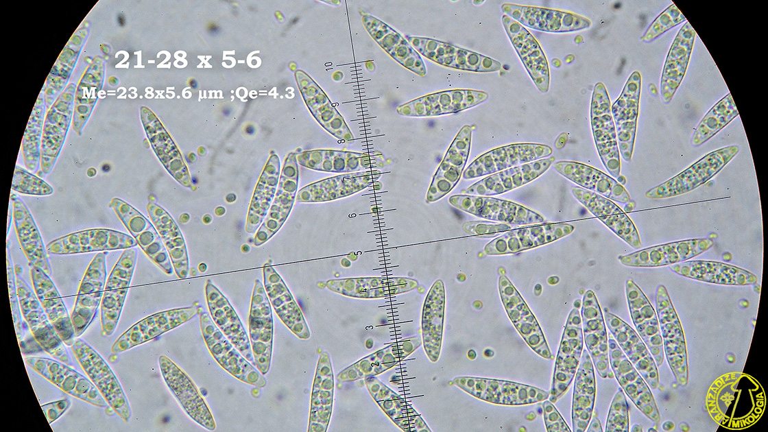 Ascocoryne cylichnium