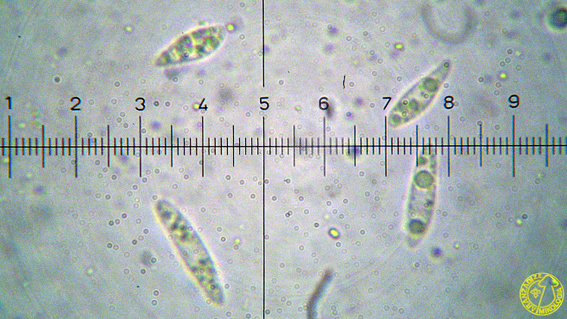 Cyathicula coronata