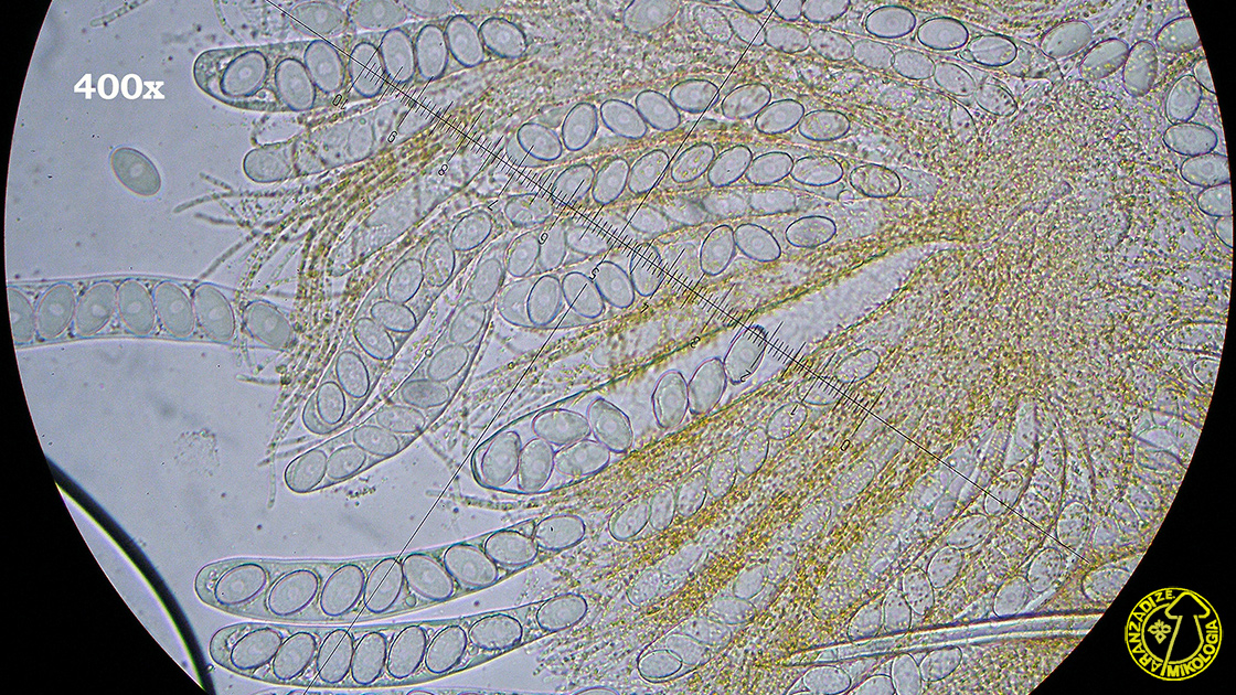 Ascobolus ciliatus