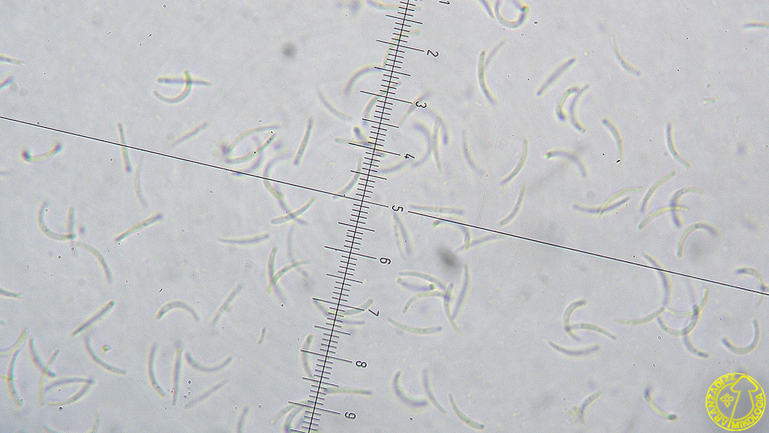 Orbilia auricolor