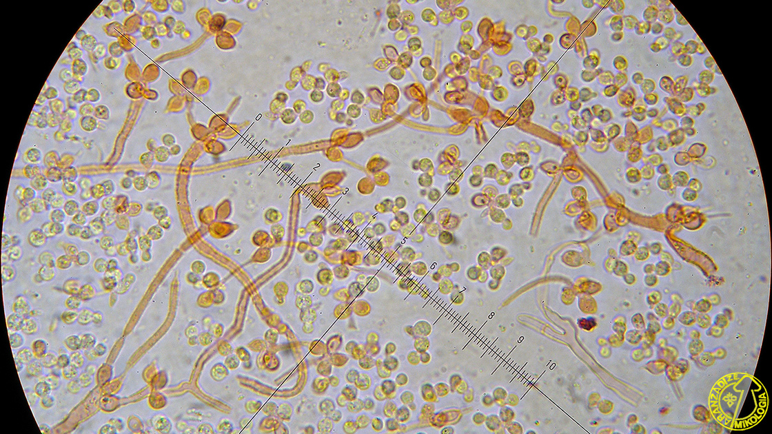 Tremella versicolor