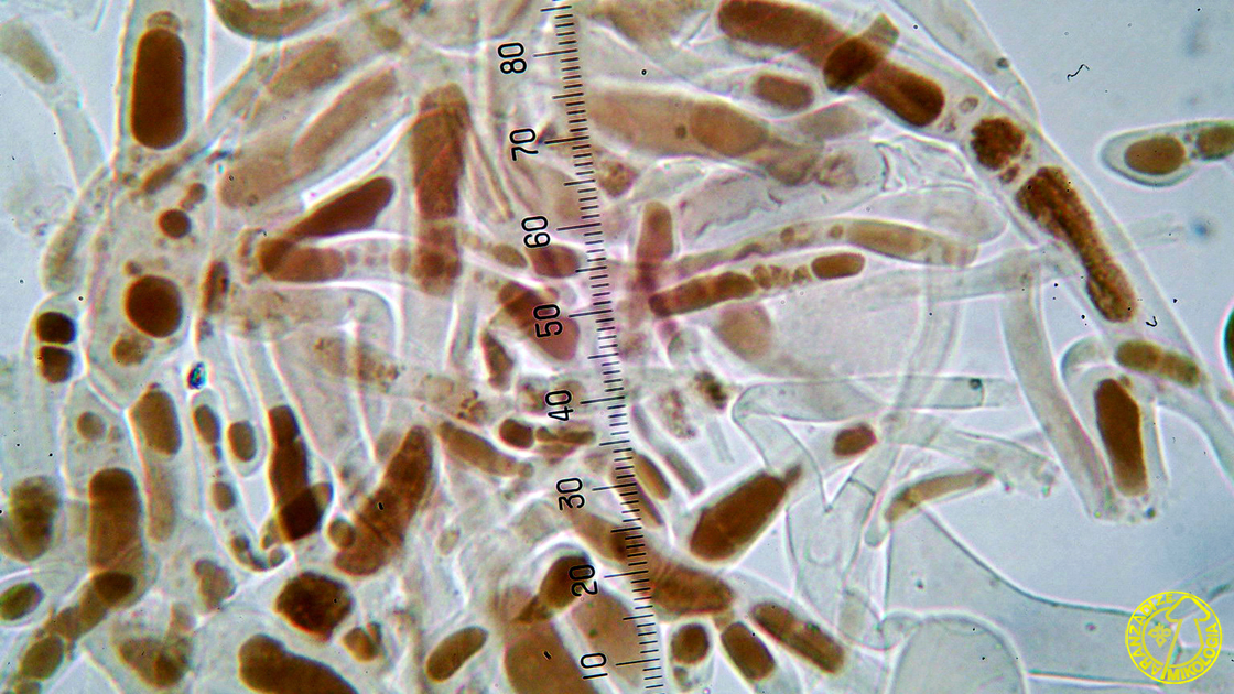 Agaricus xanthodermulus
