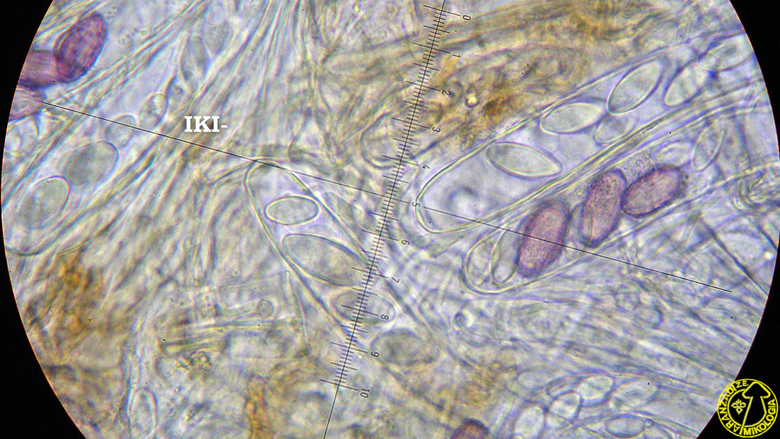 Ascobolus foliicola