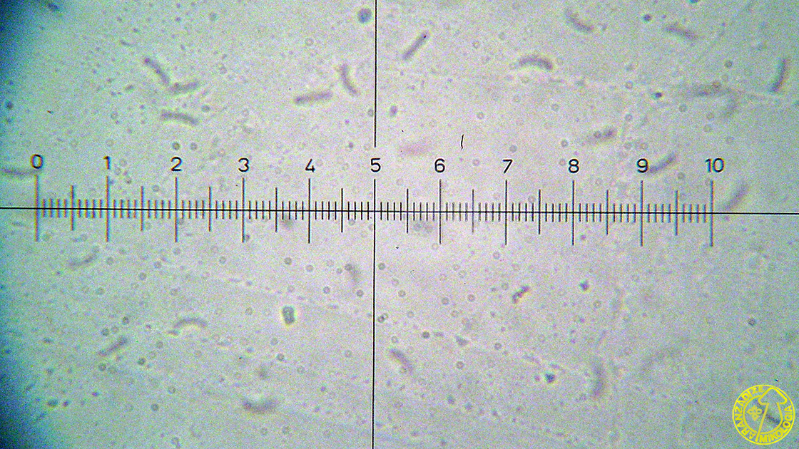 Eutypella prunastri