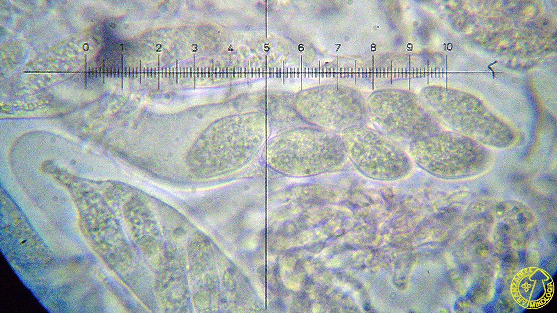 Botryosphaeria corticola