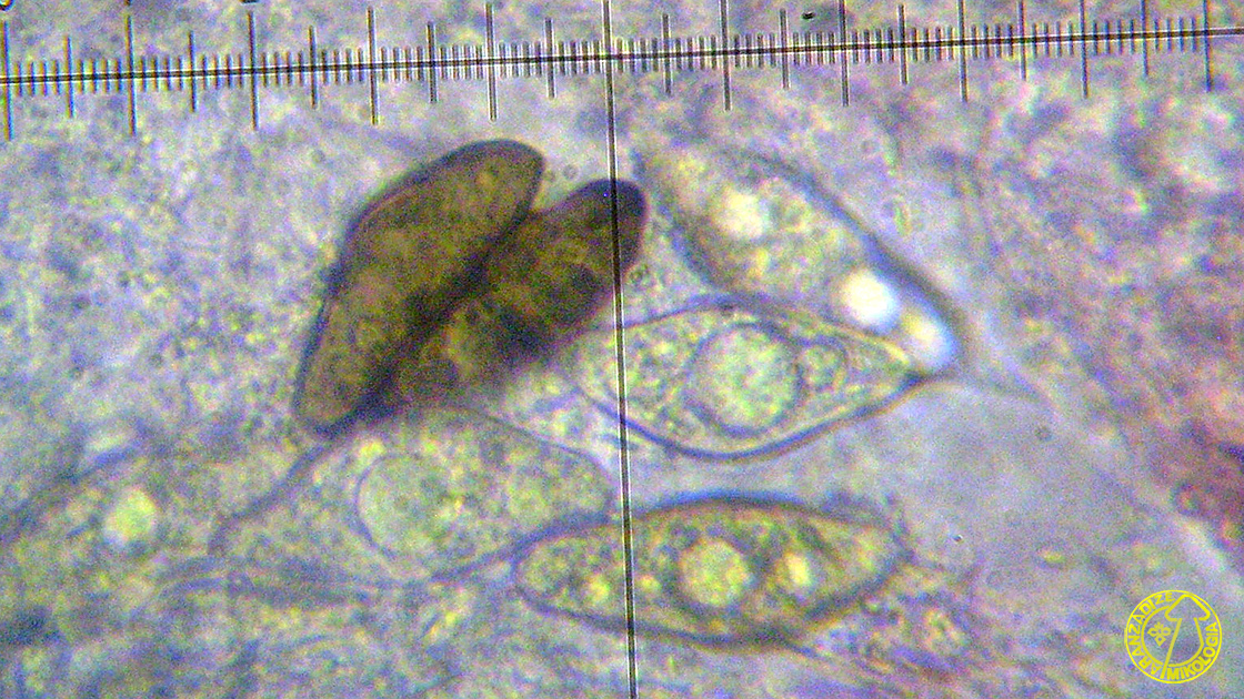 Botryosphaeria corticola