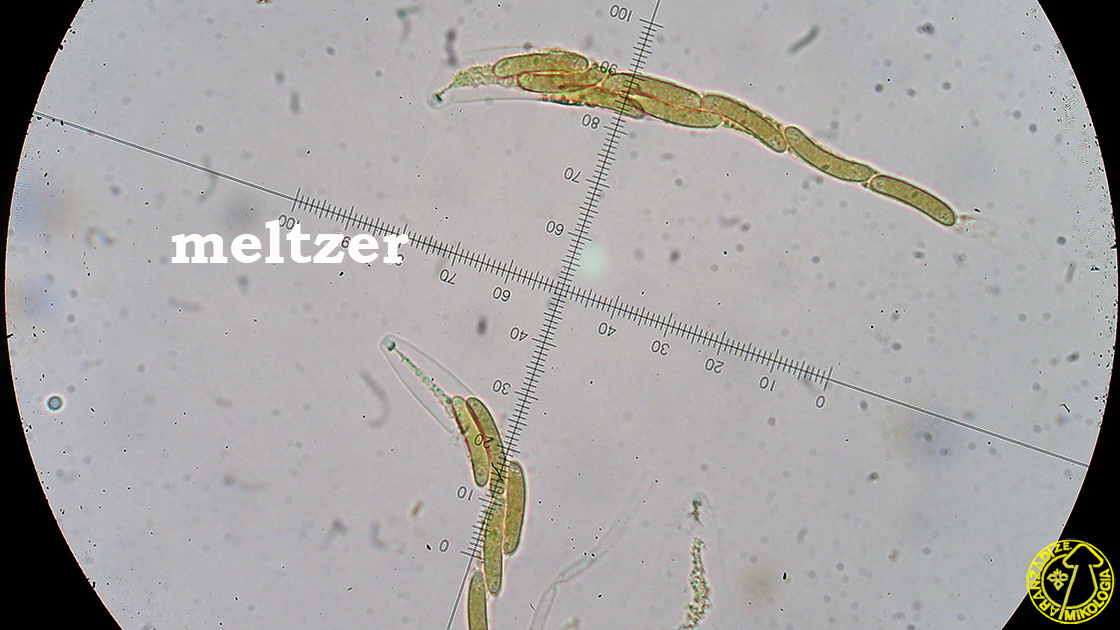 Eutypella quaternata