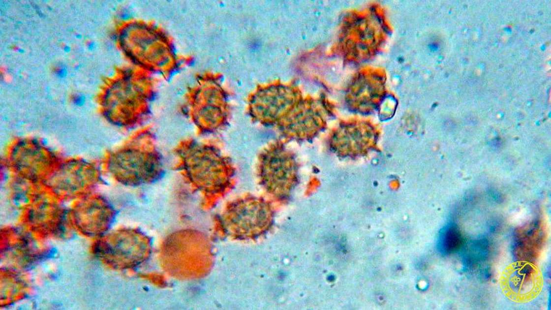 Stephanospora caroticolor